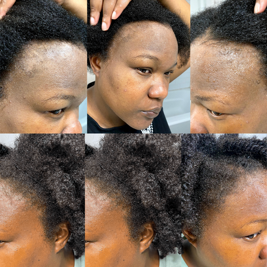 Why Your Edges Aren't Growing!
