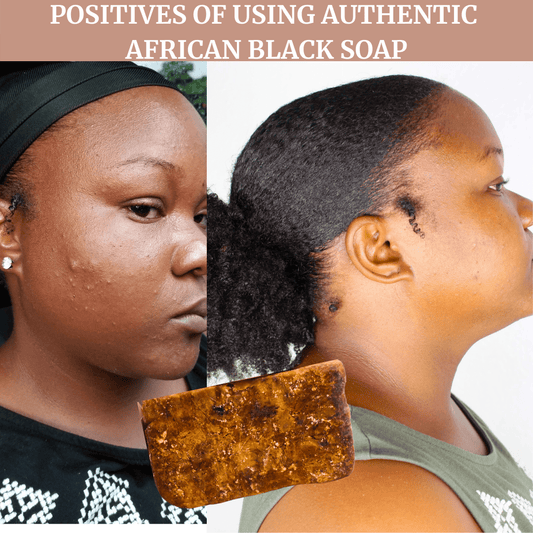 Benefits & Negatives of Using Raw Authentic African Black Soap