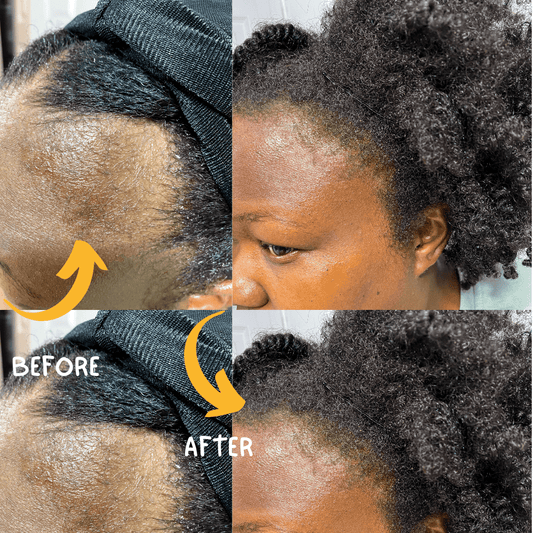 How To Grow Your Edges Using Herbs Infused In Oils