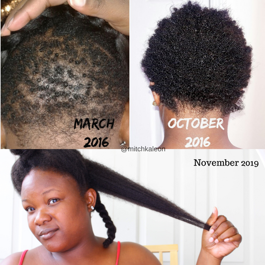 15 Tips on successful hair growth